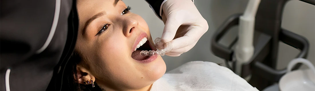 FC – Clear Aligner Treatment in Wading River NY